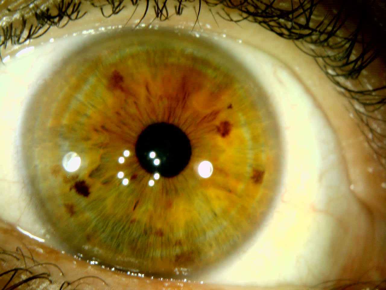 Iridology Consultation: 30 minutes (Honey Pot Health, Tamworth)